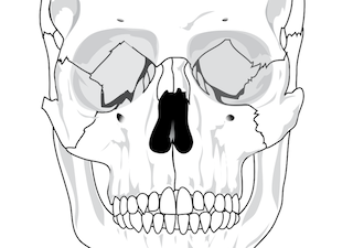 black and white rendering of a human skull